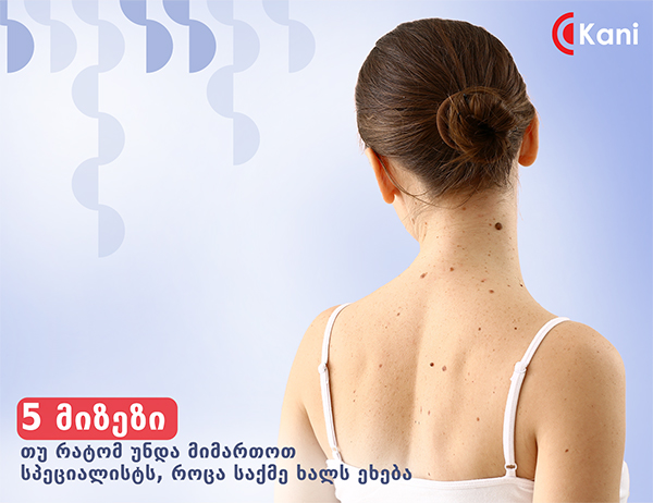 5 მიზეზი თუ რატომ უნდა მიმართოთ სპეციალისტს, როცა საქმე ხალს ეხება 5 მიზეზი თუ რატომ უნდა მიმართოთ სპეციალისტს, როცა საქმე ხალს ეხება
