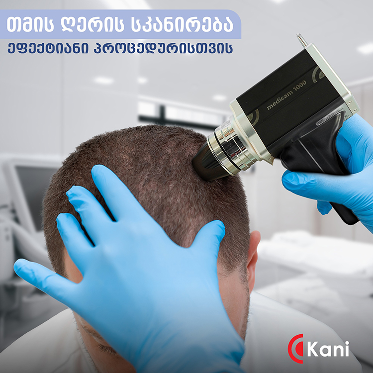 რომელ ასაკში შეიძლება თმის გადანერგვა?! რომელ ასაკში შეიძლება თმის გადანერგვა?!