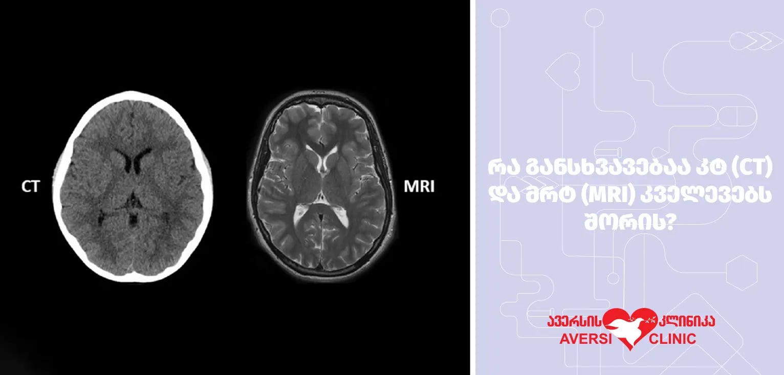 რა განსხვავებაა კტ (CT) და მრტ (MRI) კვლევებს შორის? რა განსხვავებაა კტ (CT) და მრტ (MRI) კვლევებს შორის?