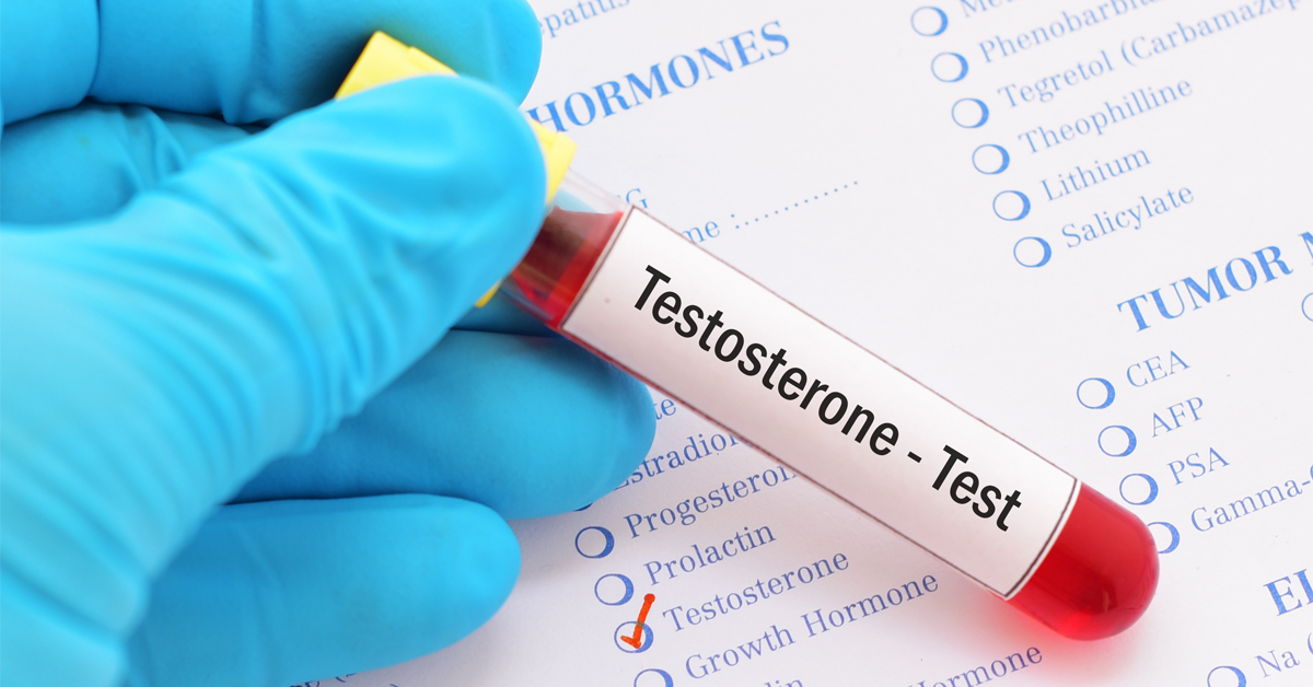 testosterone-test-1772904549.jpg