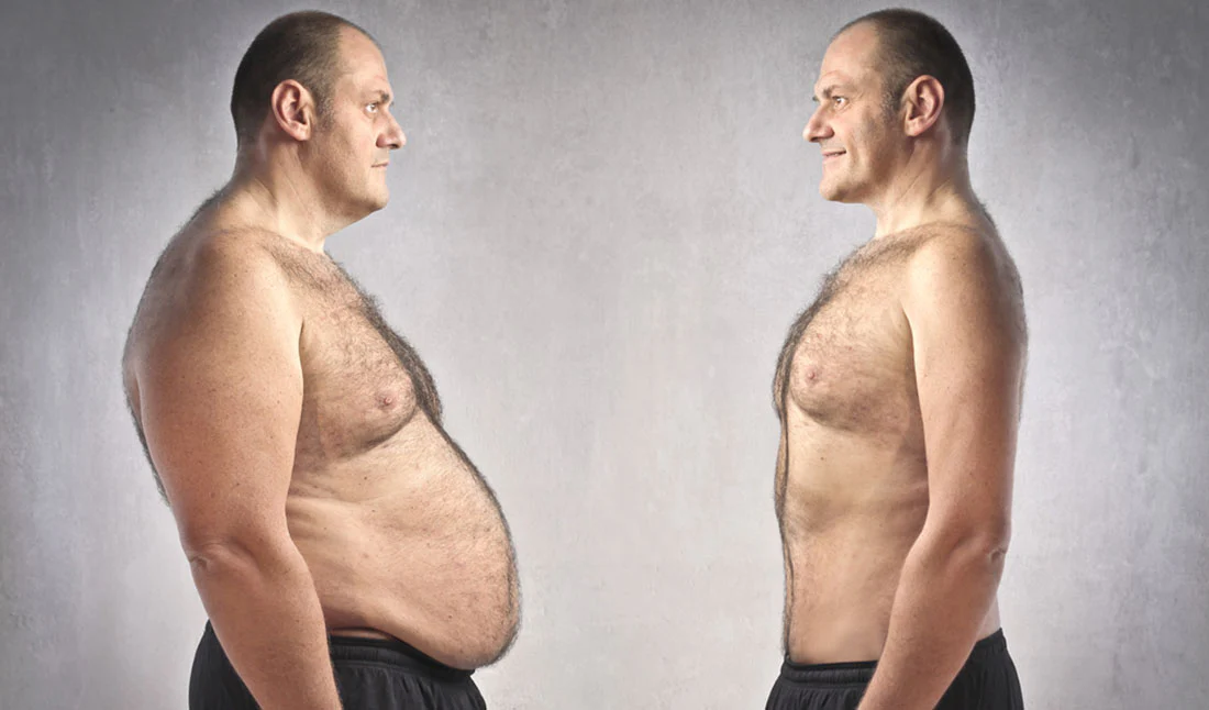 belly-fat-comparison-1780256994.webp