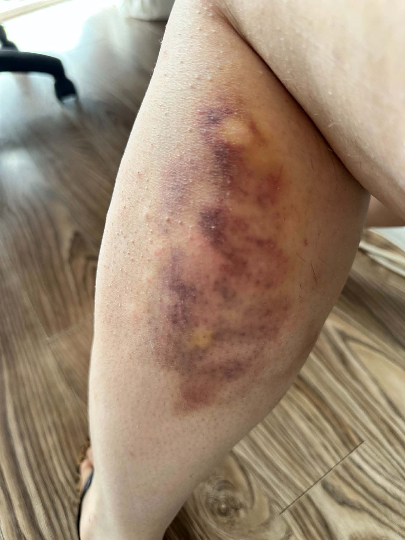 alergia-1784708405.jpg